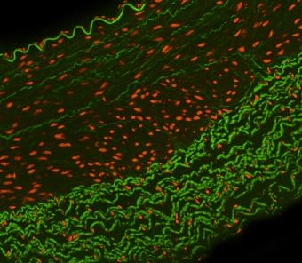 Illumination Advancing Fluorescence Microscopy in Life Sciences, Medical Realms