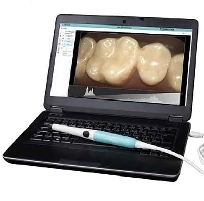 Excelitas USB Dental Camera System