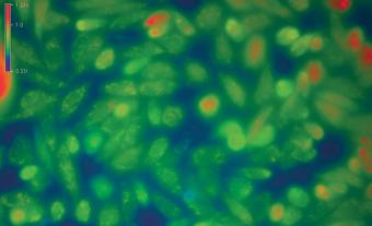 Award-Winning LED Illumination for Fluorescence from Fura-2 to Cy7.5 and Beyond