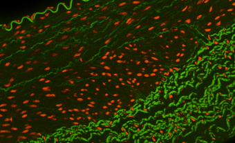 Illumination Advancing Fluorescence Microscopy in Life Sciences, Medical Realms