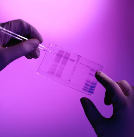 ProdPhoto_DNA-Sequencing-Slide.jpg Excelitas has expertise in DNA Sequencing